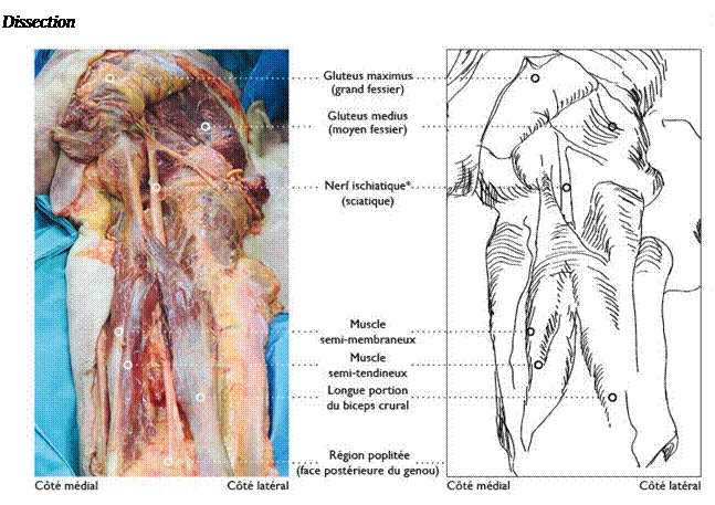 Zone de Texte: Dissection  2: membre infrieur droit rgion fessire, grand fessier sectionn et cart